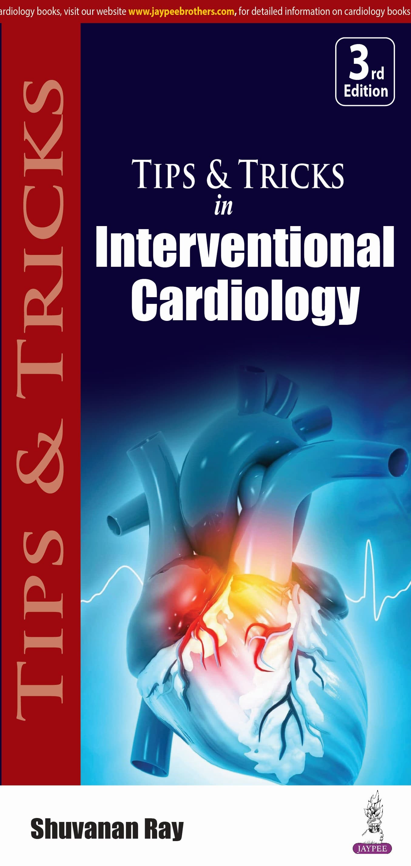 Tips and Tricks In Interventional Cardiology 3rd/2024