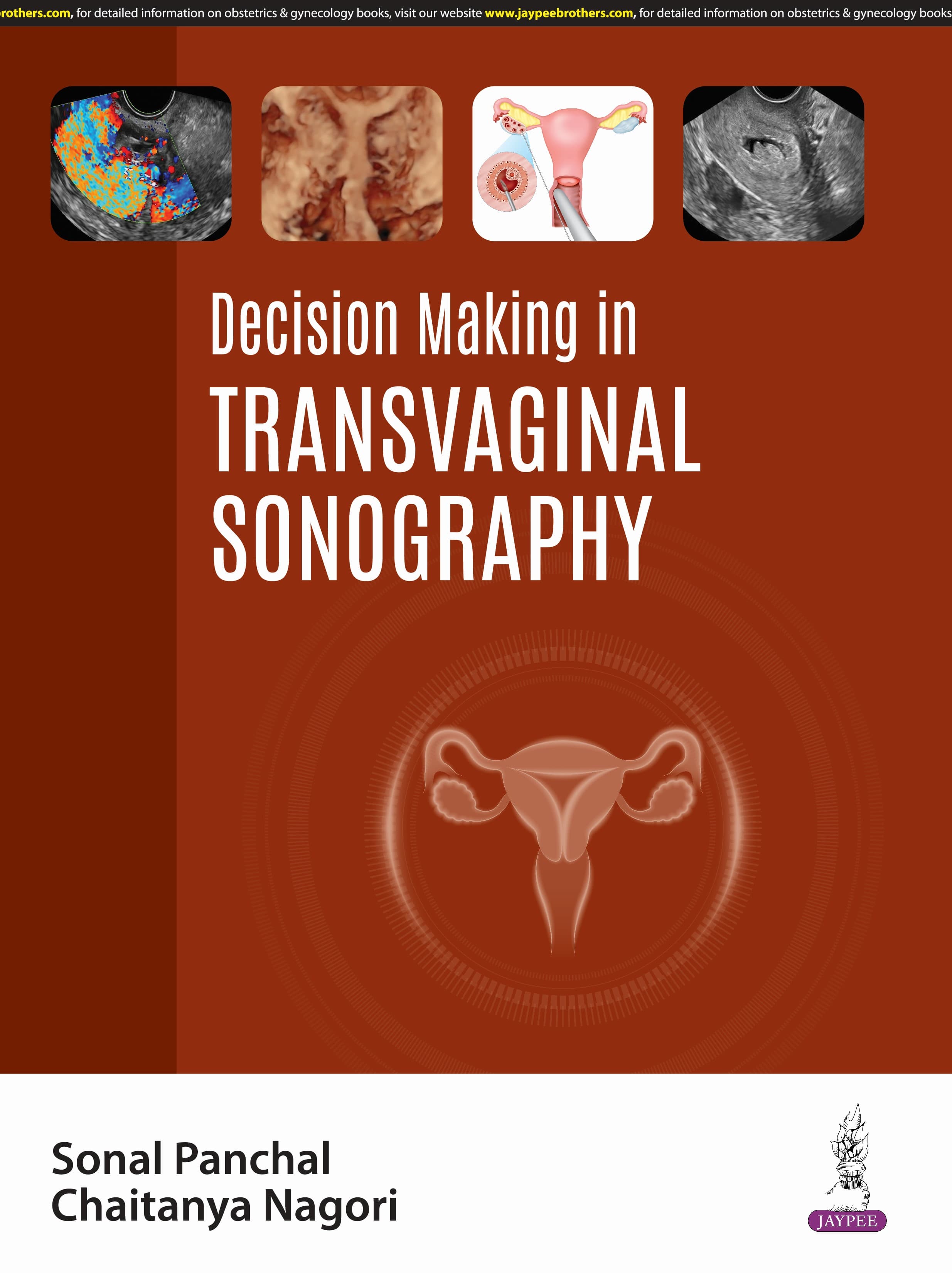 Decision Making in Transvaginal Sonography 1st/2025