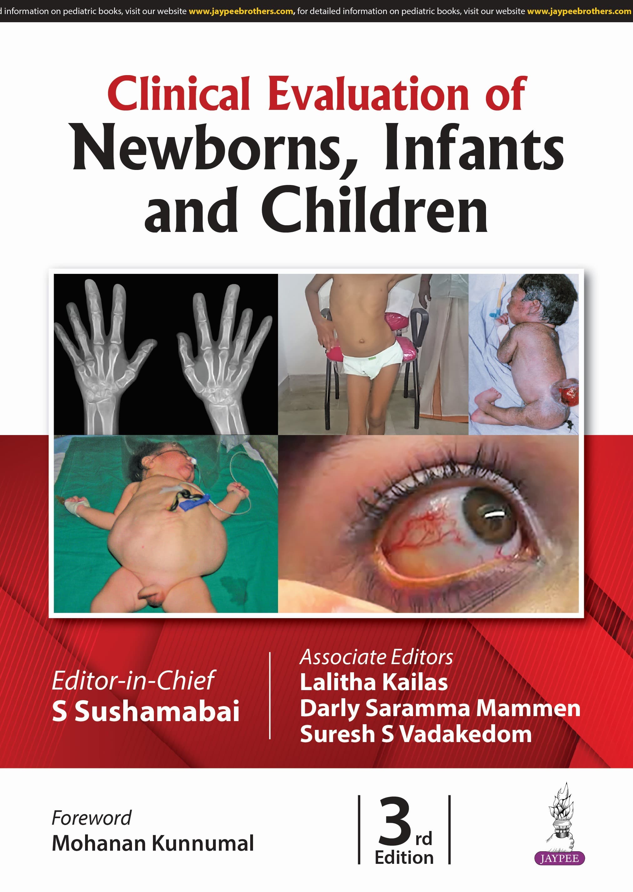 Clinical Evaluation of Newborns, Infants and Children 3rd/2025