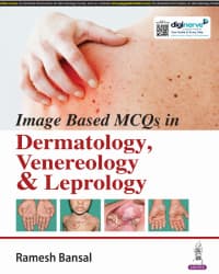 Image Based Mcqs In Dermatology, Venereology & Leprology 1st/2024