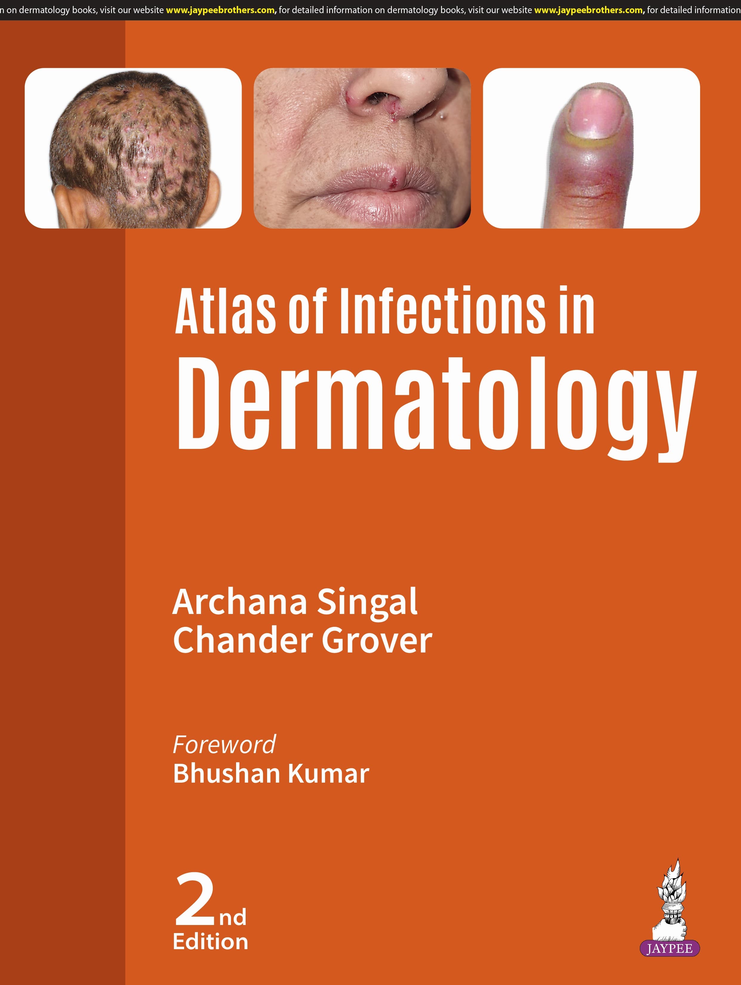 Atlas of Infections in Dermatology 2nd/2025