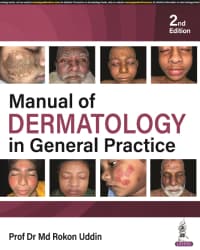 Manual of Dermatology in General Practice 2nd/2024
