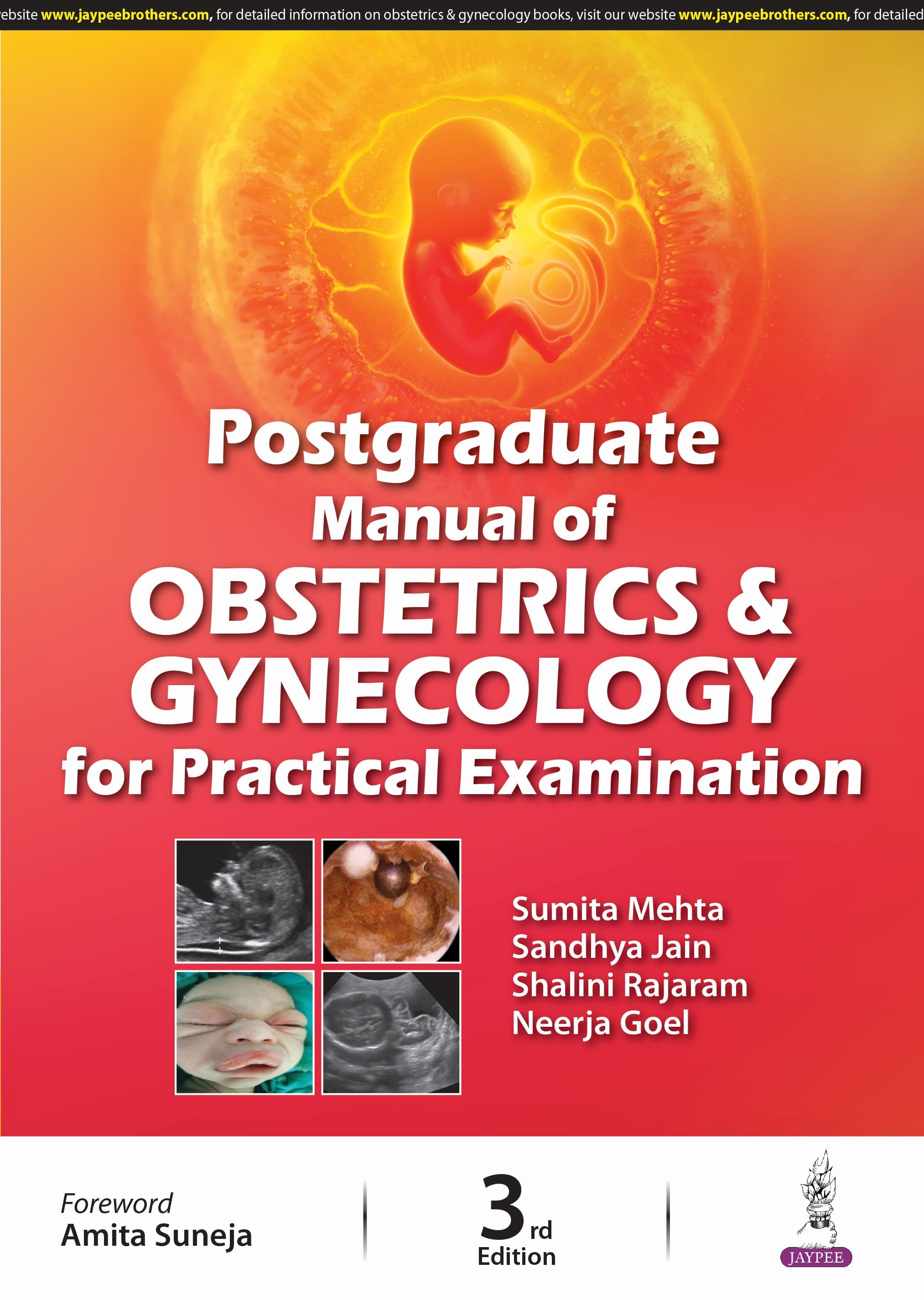 Postgraduate Manual of Obstetrics and Gynecology for Practical Examination 3rd/2024