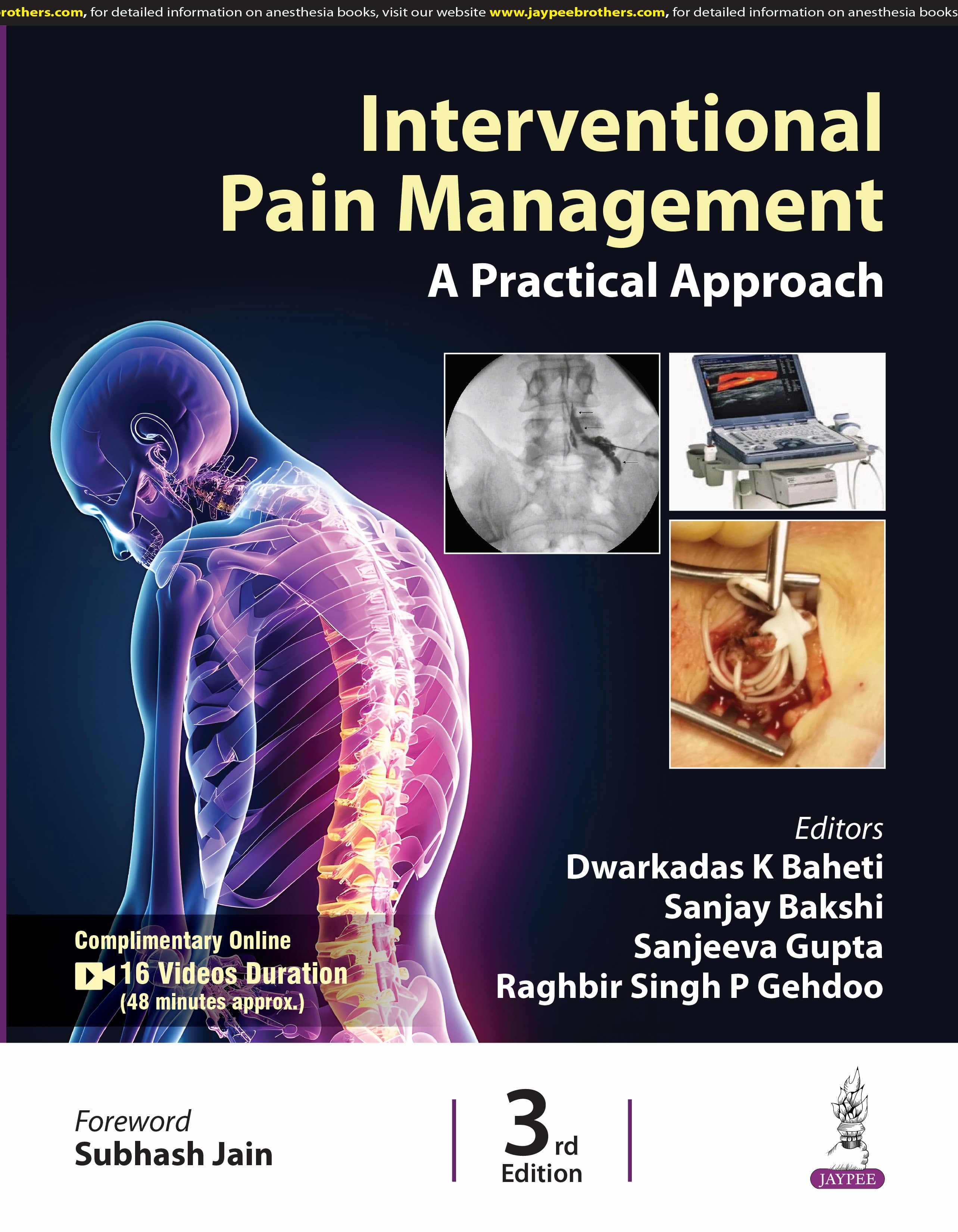 Interventional Pain Management A Practical Approach 3rd/2025