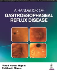 Handbook of Gastroesophageal Reflux Disease 1st/2024