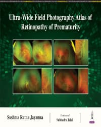 Ultra-Wide Field Photography Atlas of Retinopathy of Prematurity 1st/2024