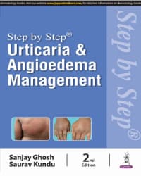 Step By Step Urticaria And Angioedema Management 2nd/2024