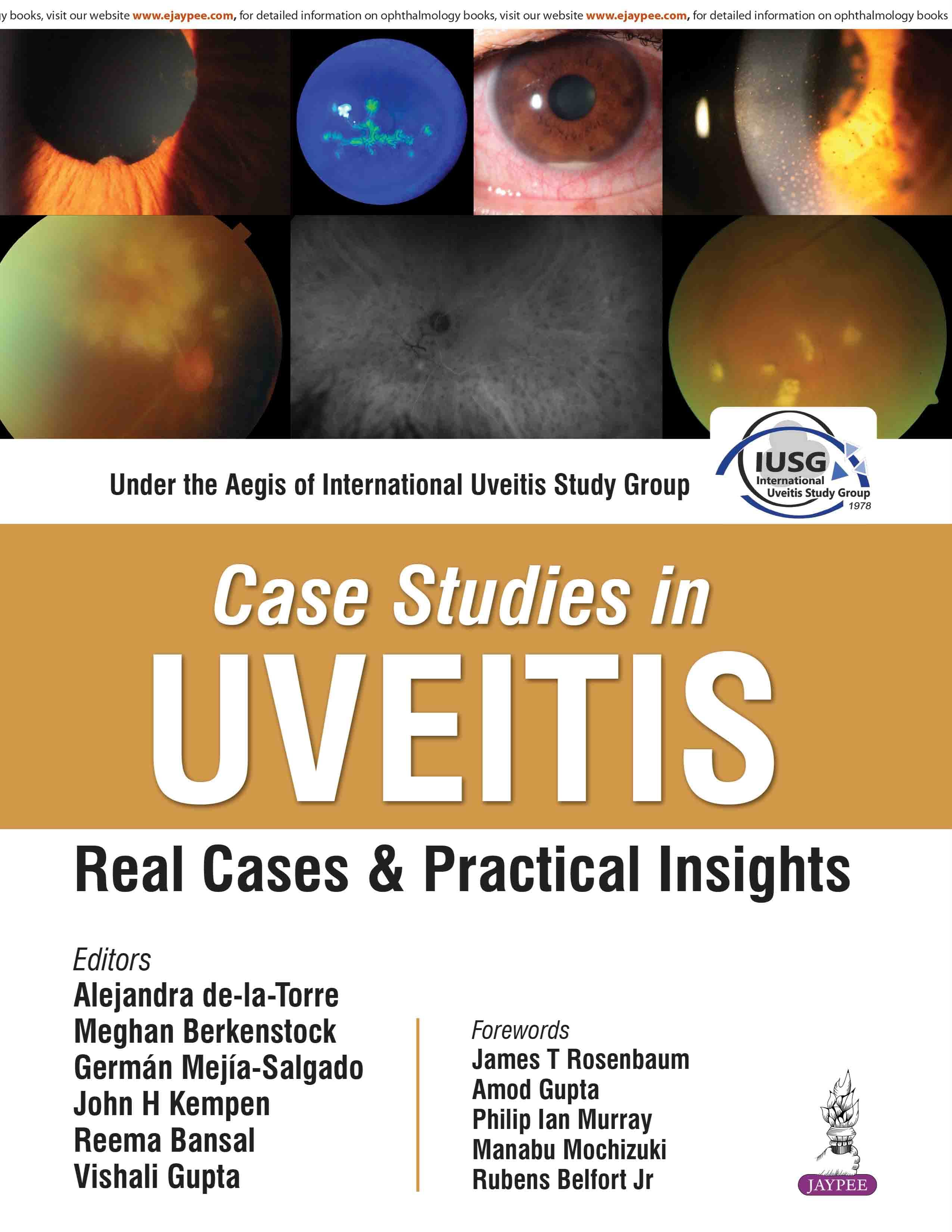 Case Studies in UVEITIS Real Cases and Practical Insights 1st/2026