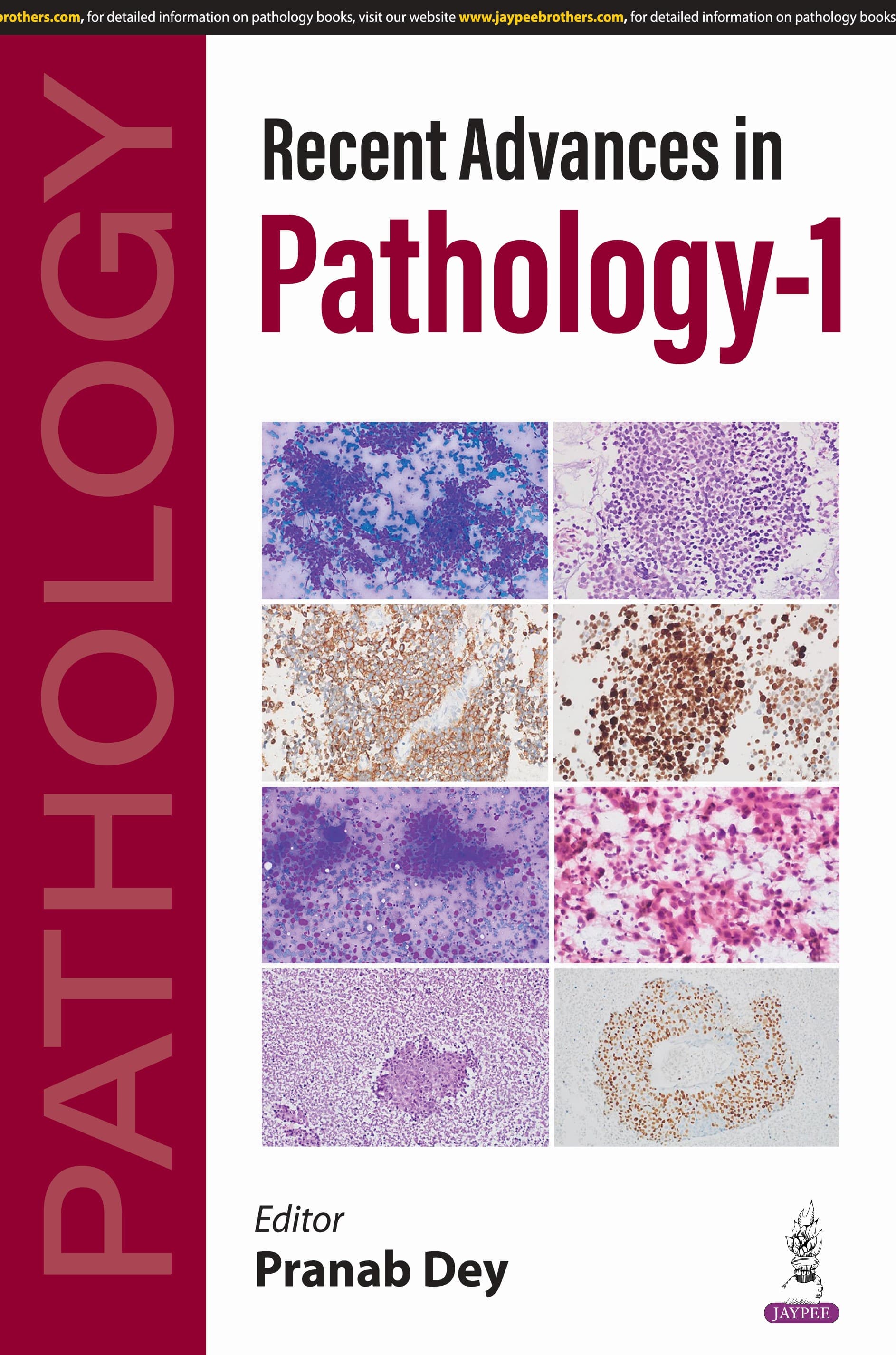 Recent Advances in Pathology-1 1st/2025