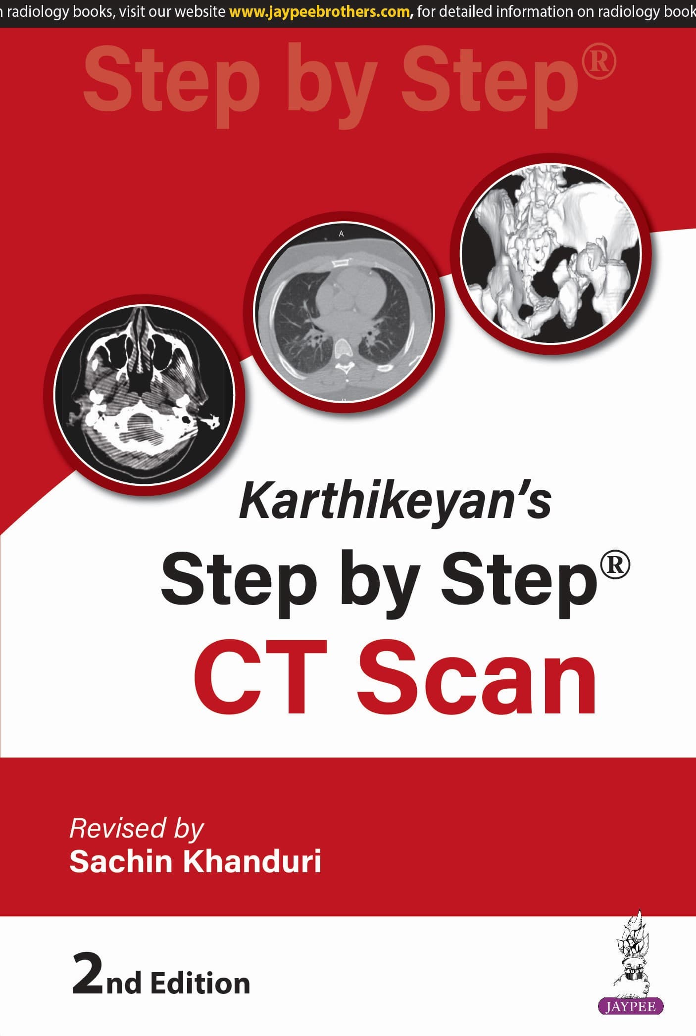 Karthikeyans Step by Step CT Scan 2nd/2025