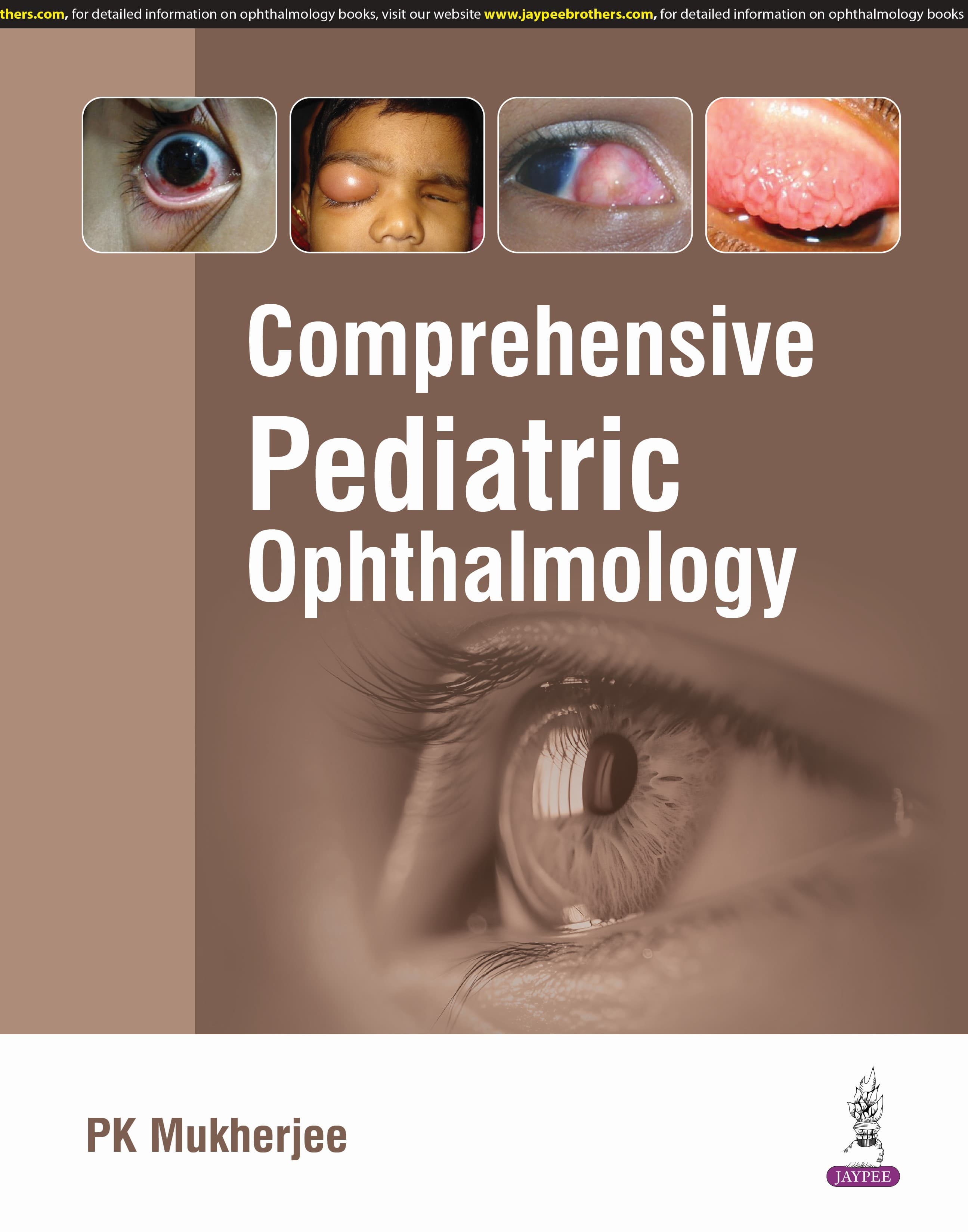 Comprehensive Pediatric Ophthalmology 1st/2025