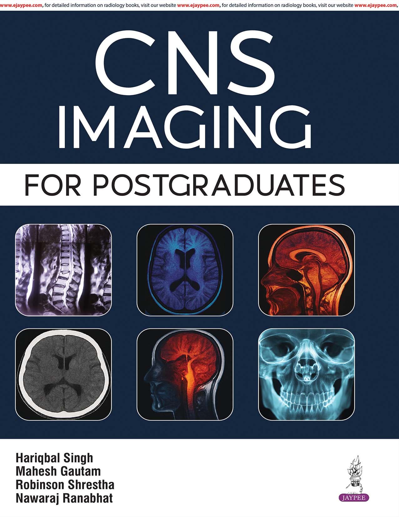 CNS Imaging for Postgraduates 1st/2026