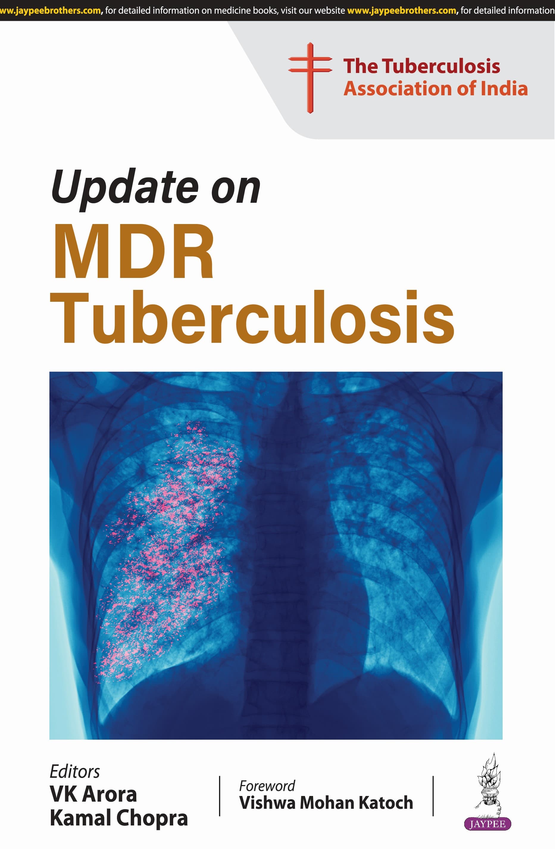 Update on MDR Tuberculosis 1st/2025