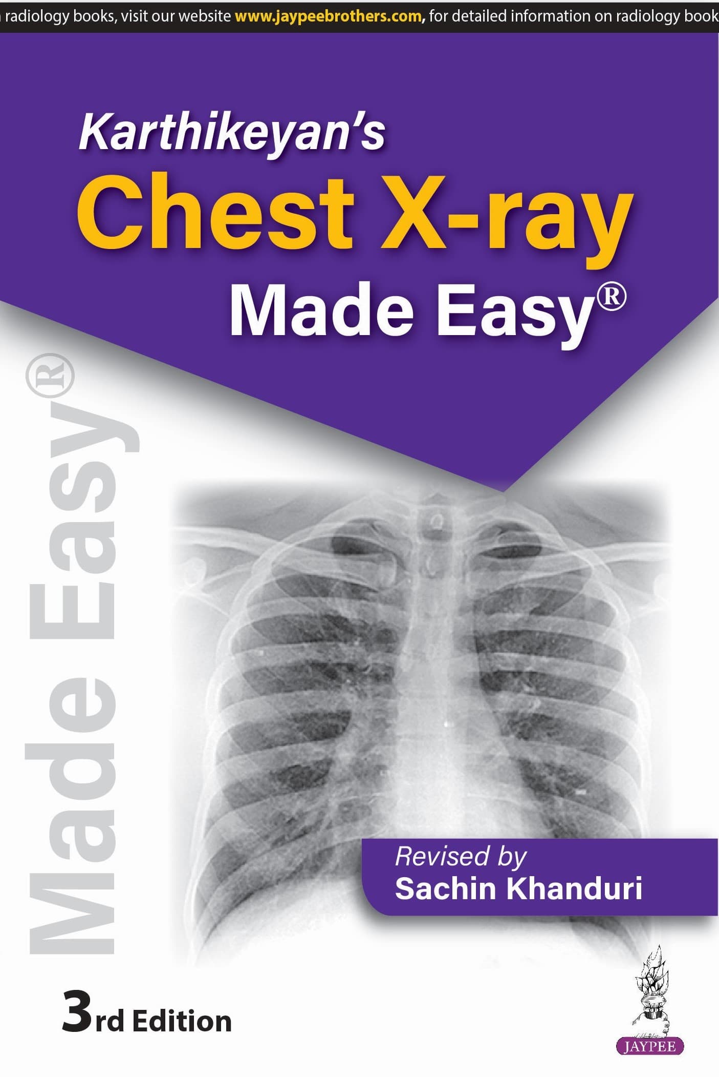 Karthikeyans Chest X-Ray Made Easy 3rd/2025