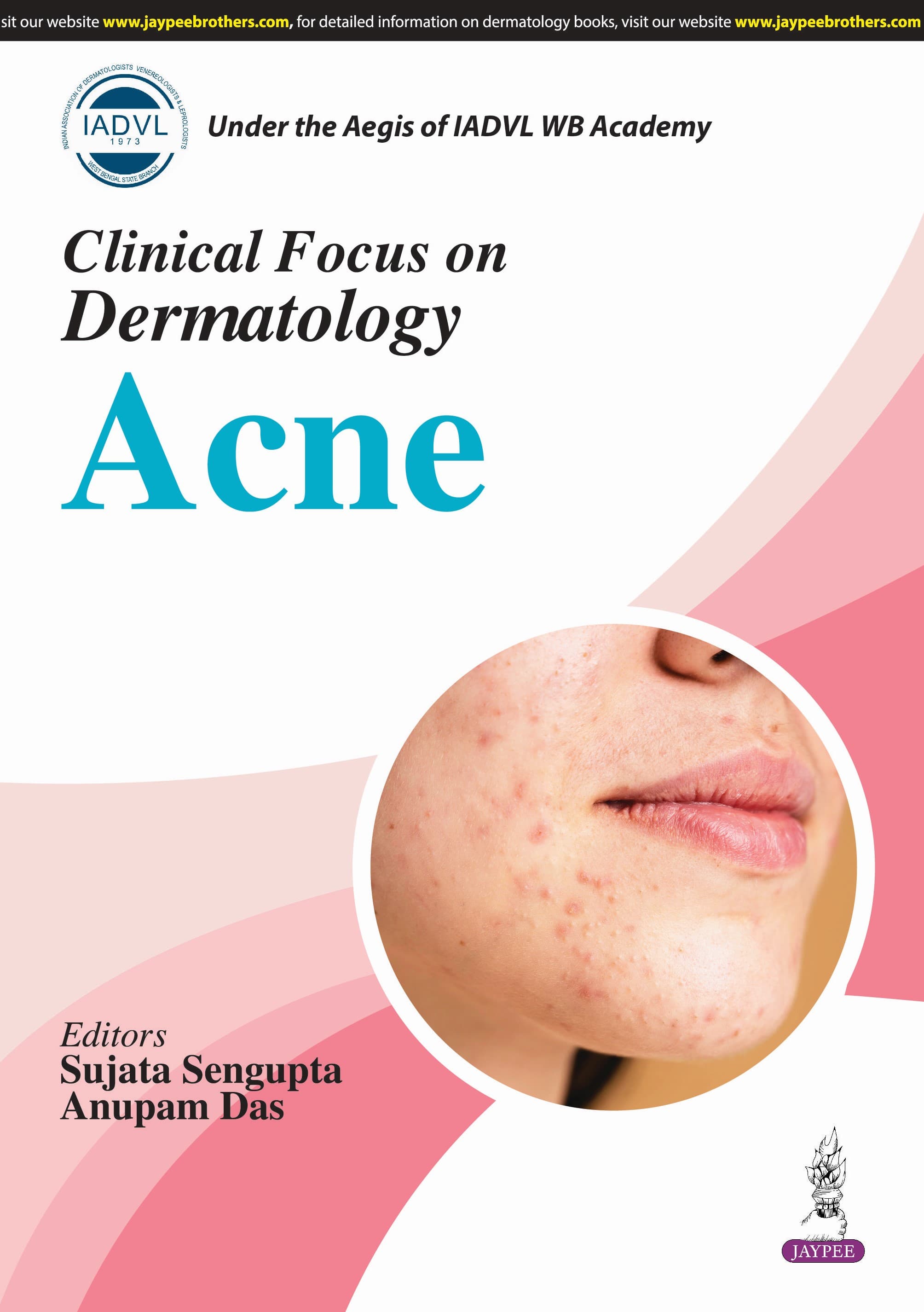 IADVL Clinical Focus on Dermatology Acne 1st/2025