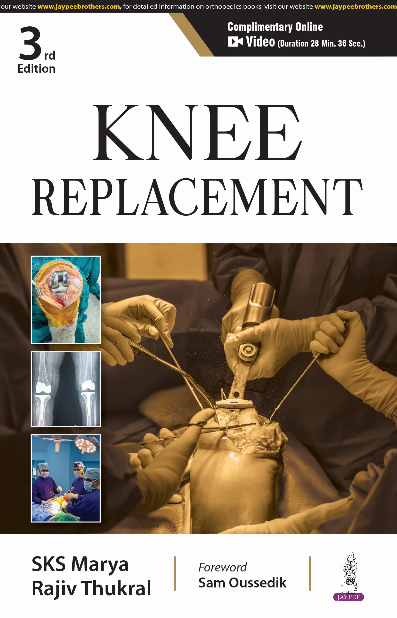 Knee Replacement 3rd/2025