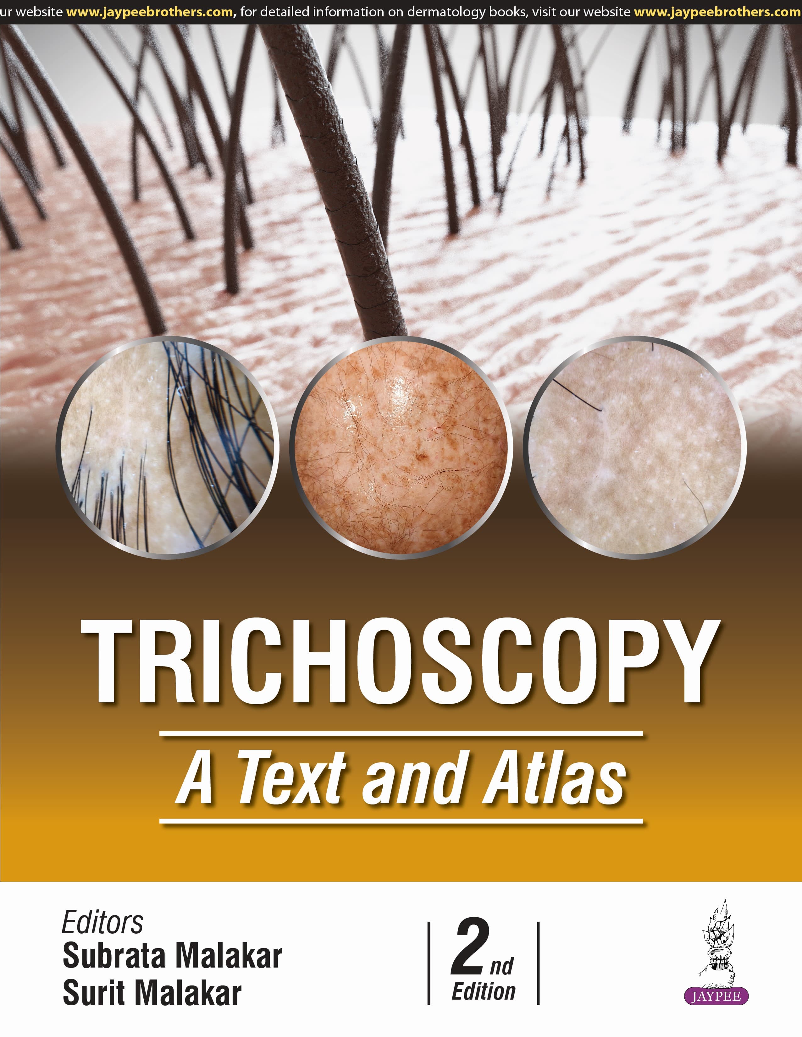 Trichoscopy A Text and Atlas 2nd/2025