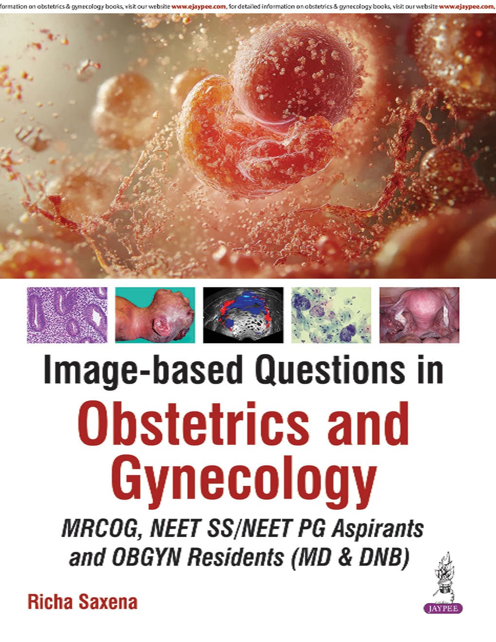 Image based Questions in Obstetrics and Gynecology 1st/2026