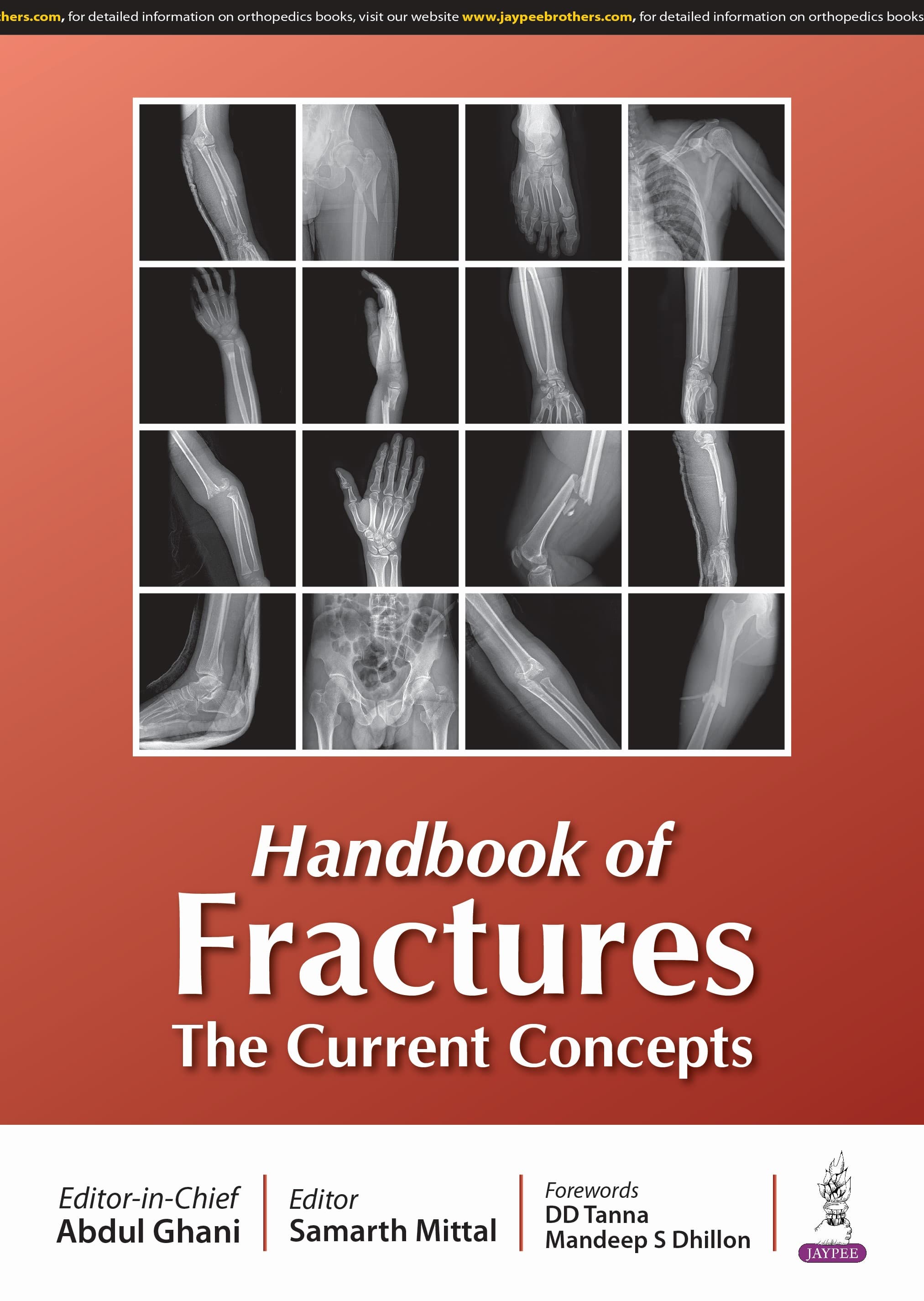 Handbook of Fractures: The Current Concepts 1st/2025