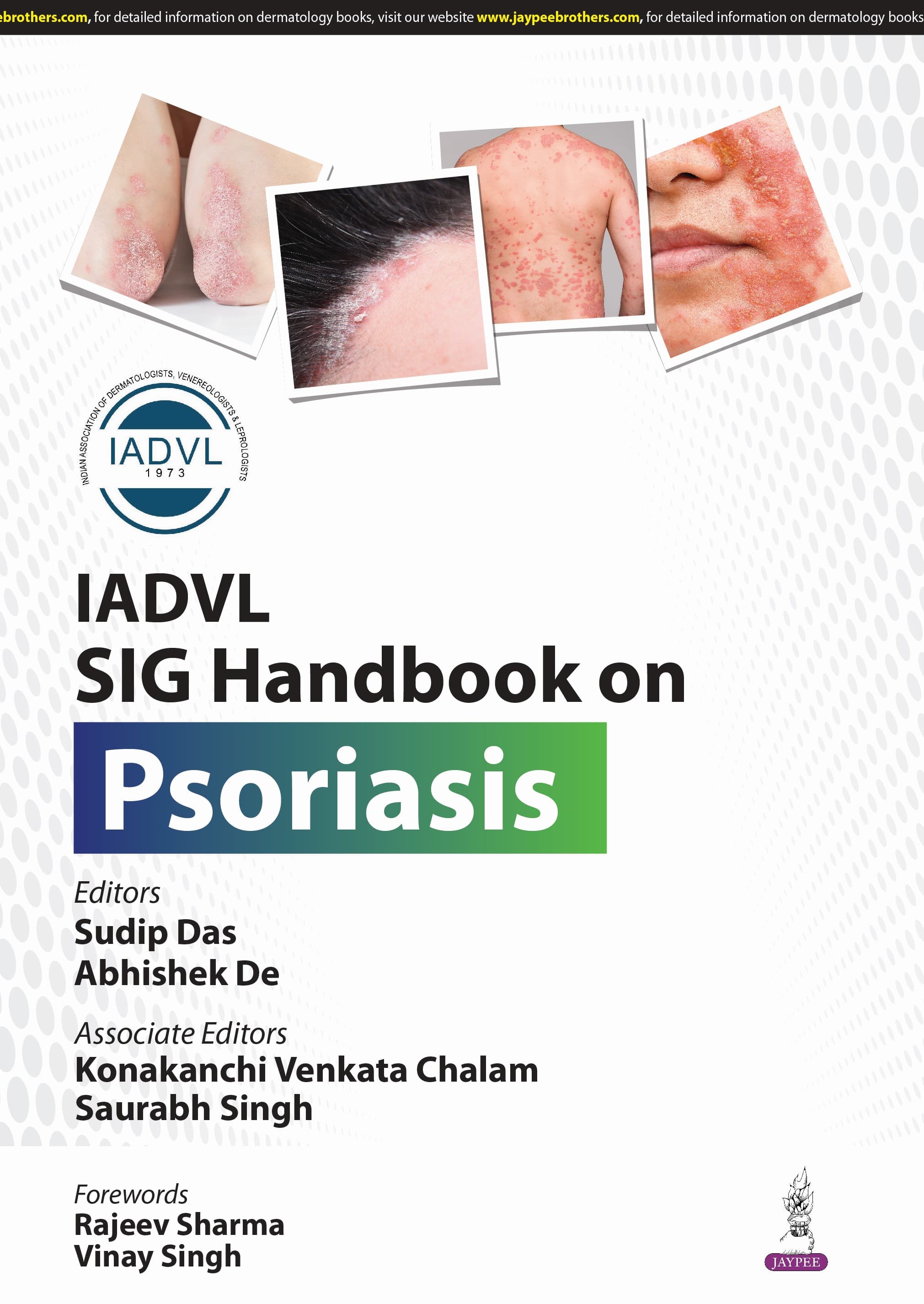 IADVL SIG Handbook on Psoriasis 1st/2025