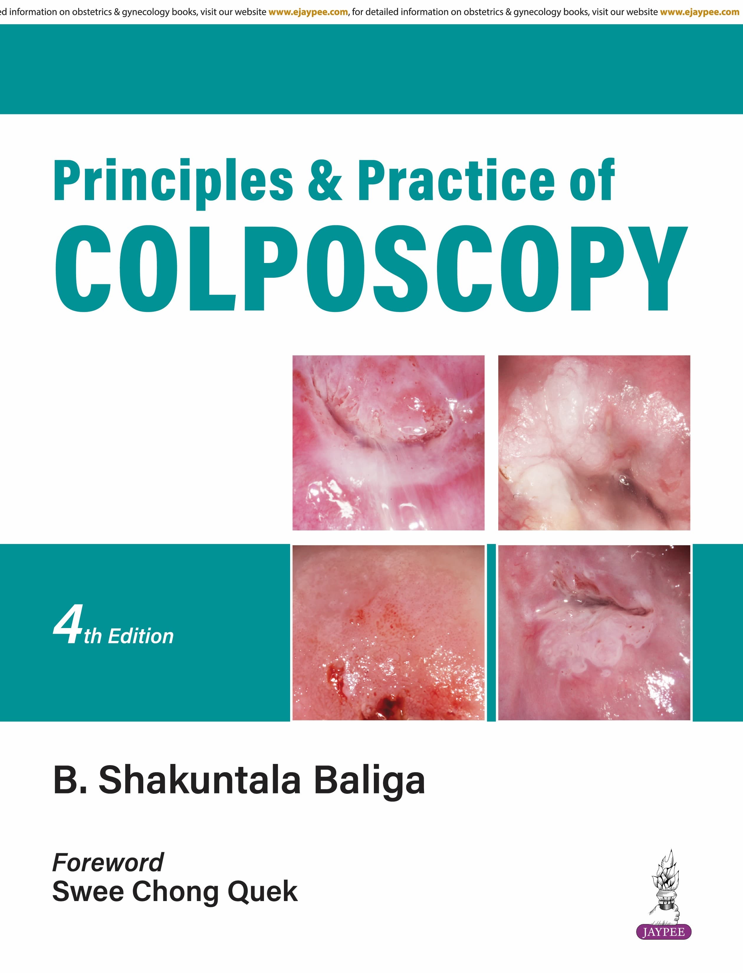 Principles and Practice of Colposcopy 4th/2026