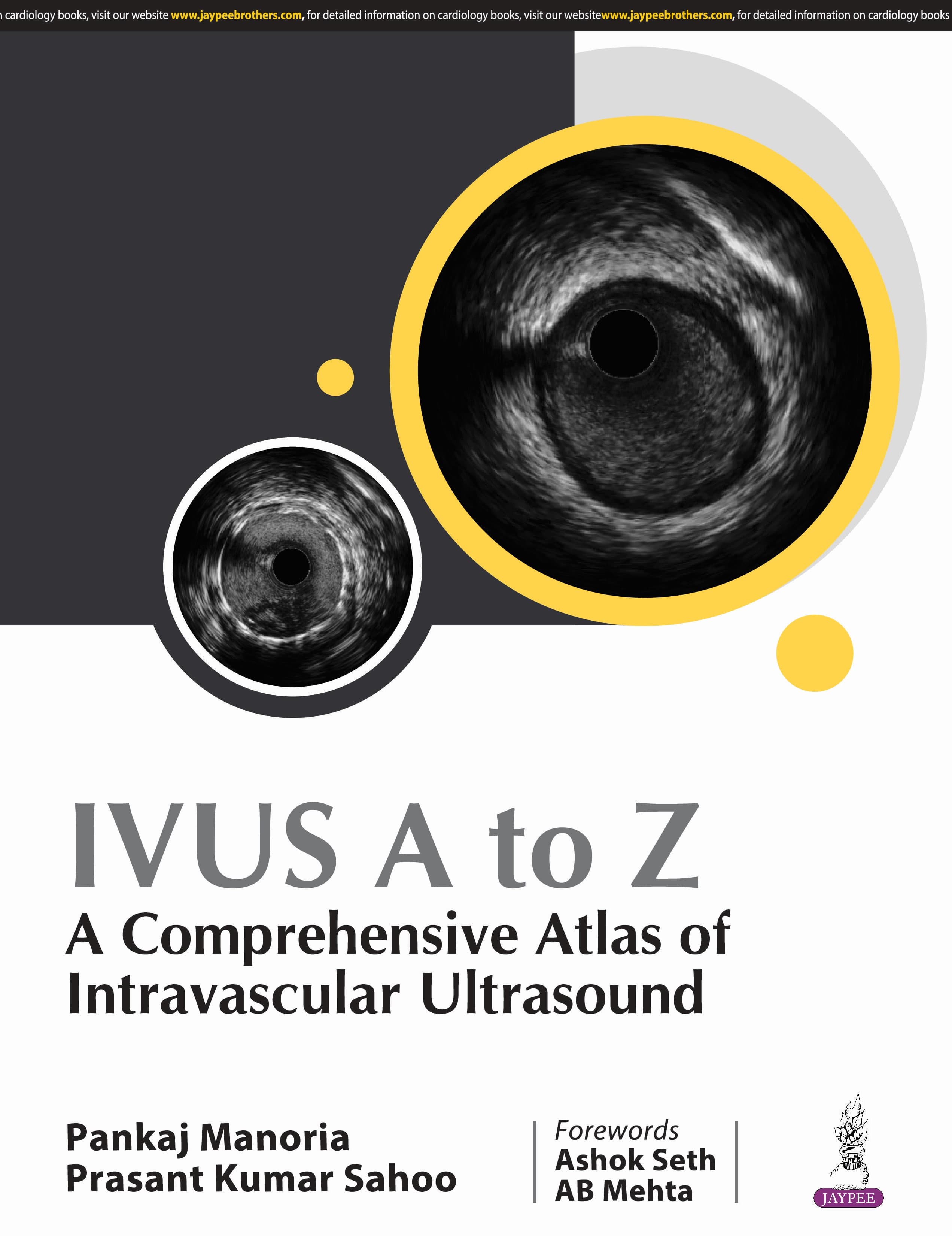 IVUS A to Z: A Comprehensive Atlas of Intravascular Ultrasound 1st/2025