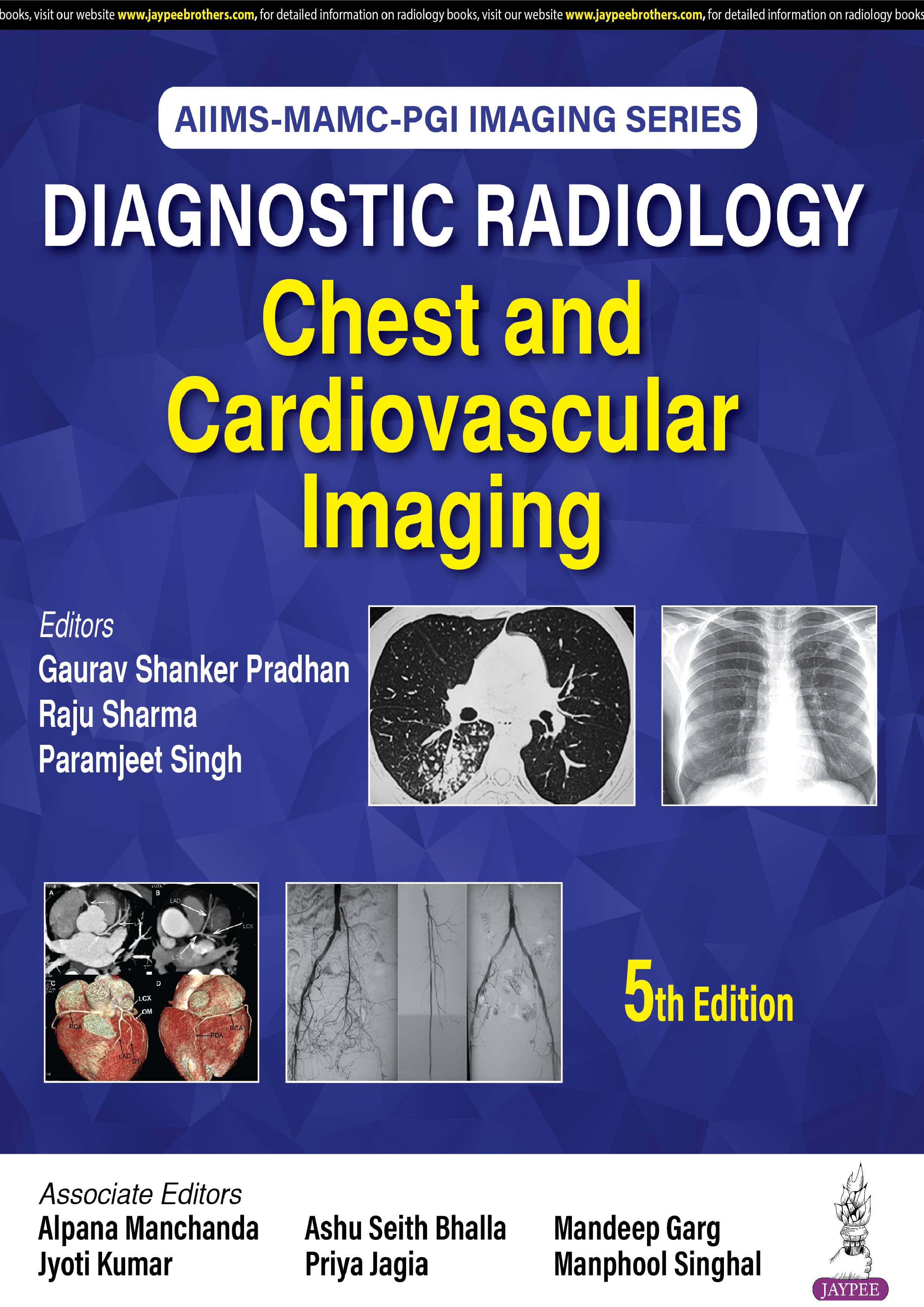 Diagnostic Radiology: Chest and Cardiovascular Imaging 5th/2025