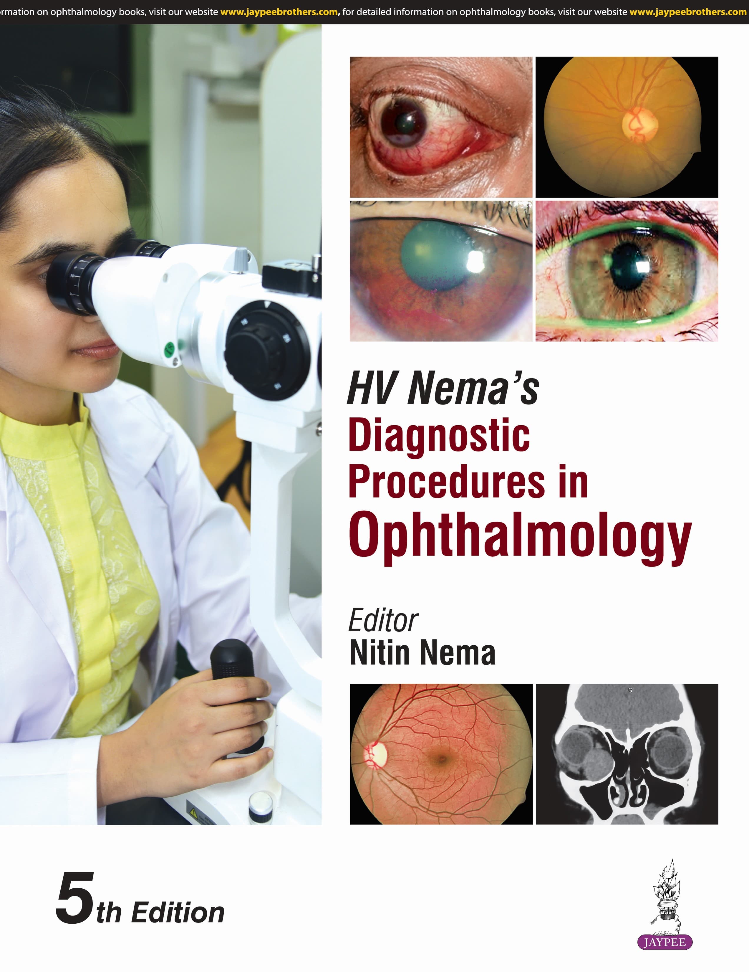 HV Nema’s Diagnostic Procedures in Ophthalmology 5th/2025