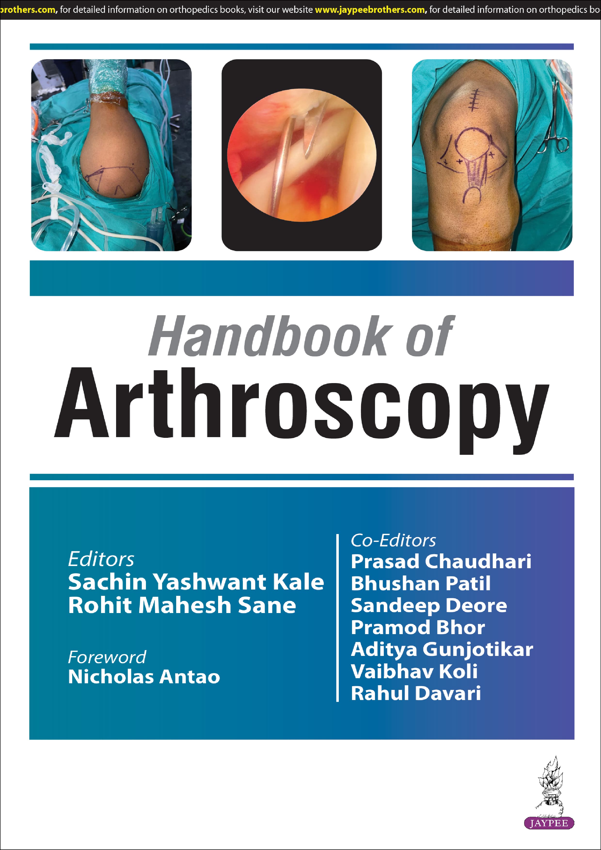 Handbook of Arthroscopy 1st/2025