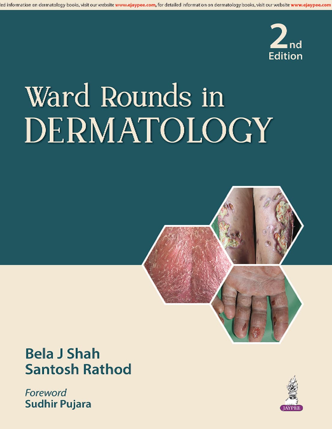 Ward Rounds in Dermatology 2nd/2026