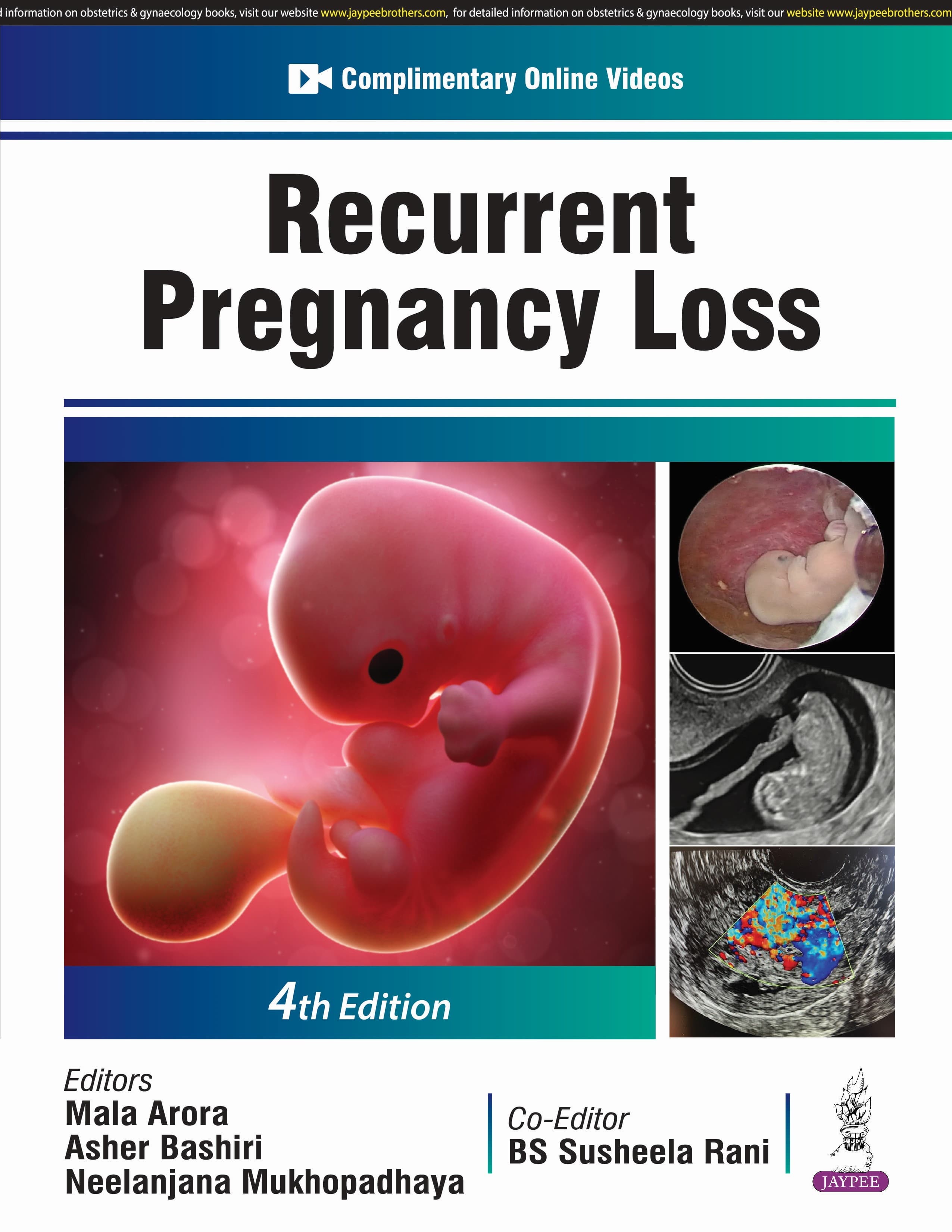 Recurrent Pregnancy Loss 4th/2025