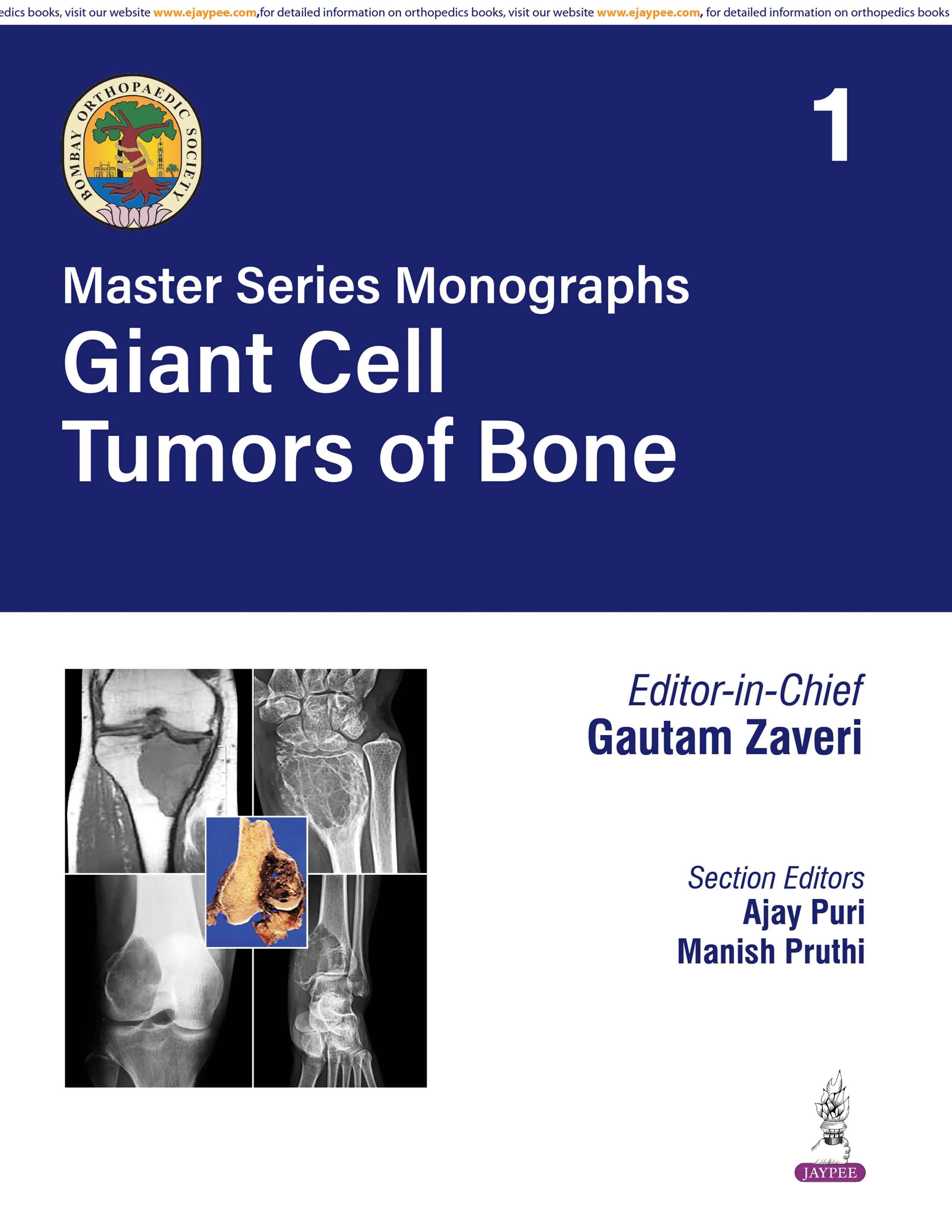 BOS Master Series Monographs: Giant Cell Tumors of Bone 1st/2026 (Vol 1)