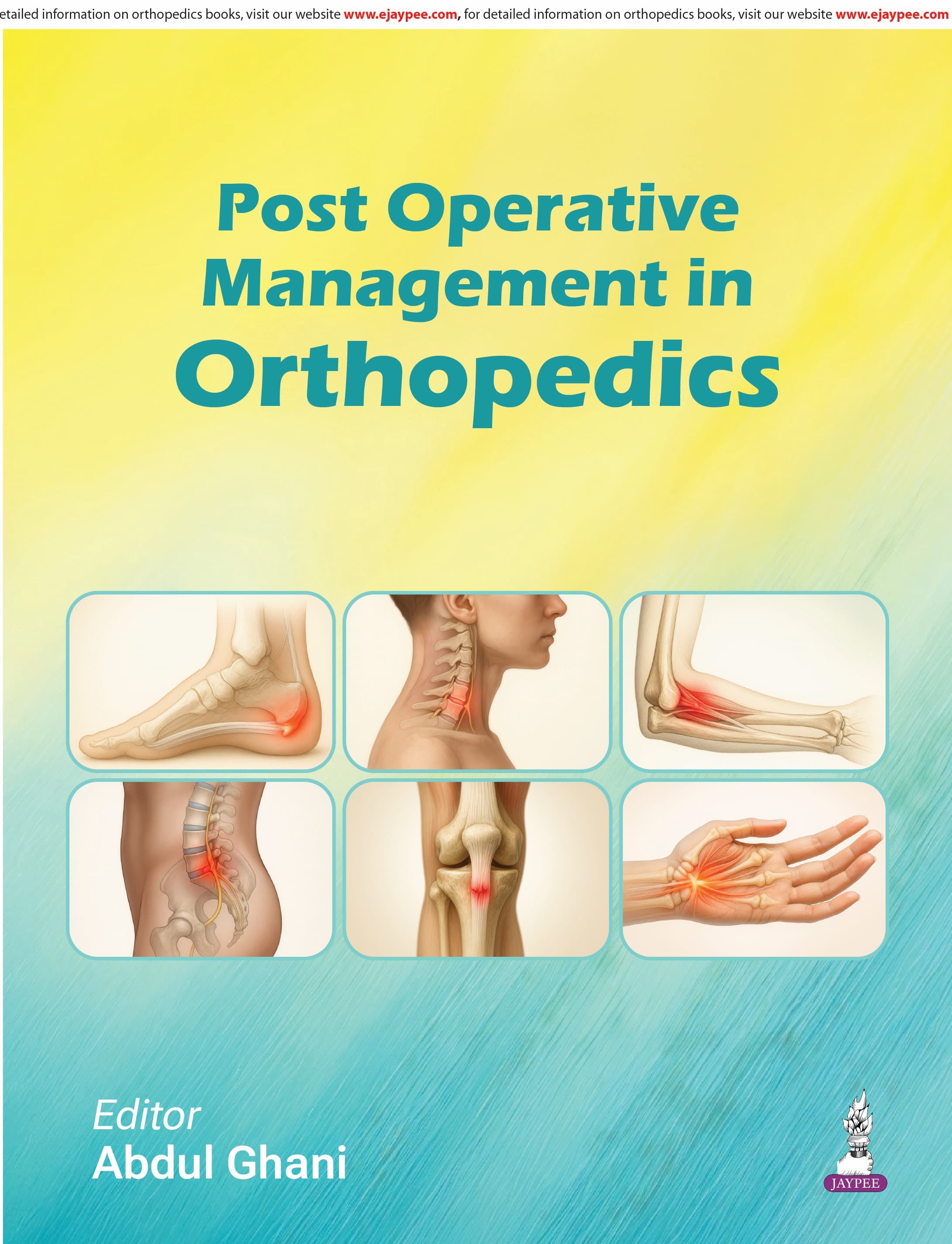 Post Operative Management in Orthopedics 1st/2026