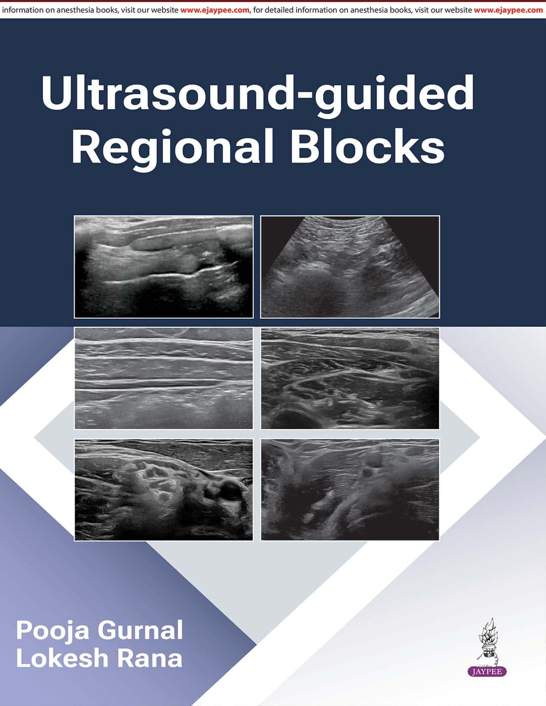 Ultrasound Guided Regional Blocks 1st/2026