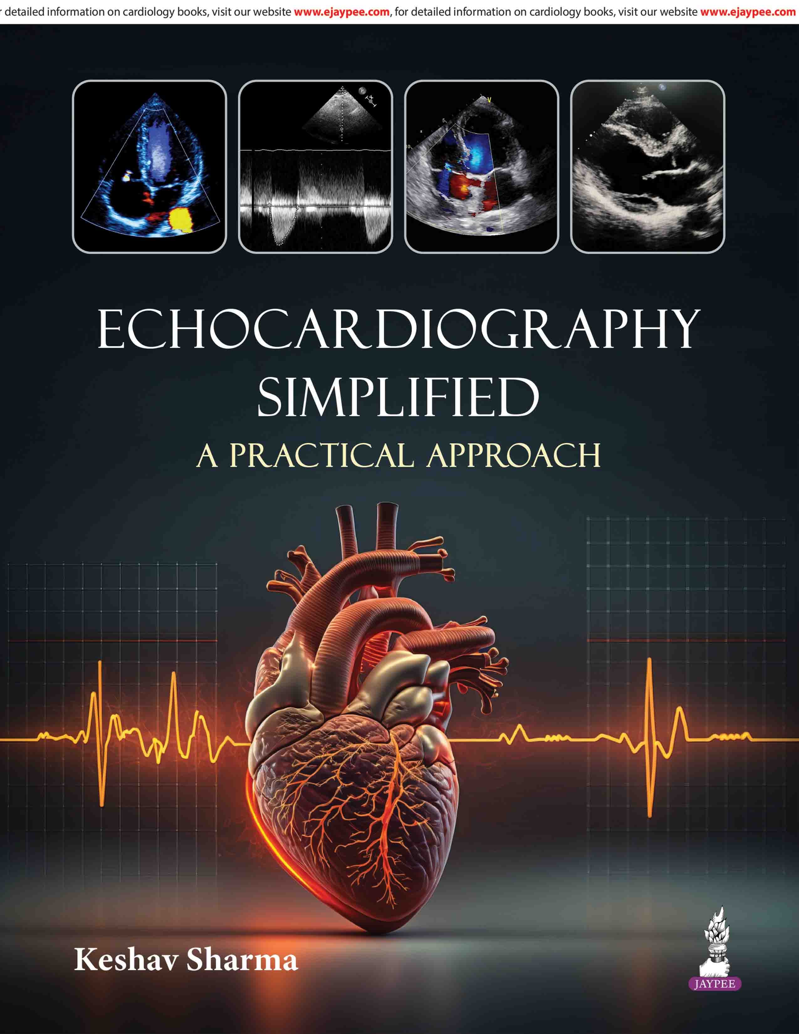 Echocardiography Simplified (A Practical Approach) 1st/2027