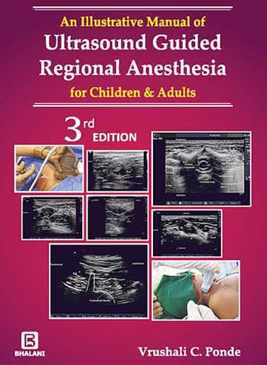 Illustrative Manual Of Ultrasound Guided Regional Anesthesia For Children & Adults 3rd/2019