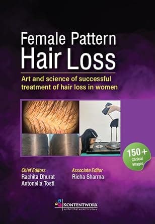 Female Pattern Hair Loss 1st/2024