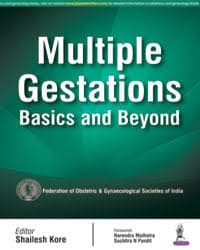 Multiple Gestations Basics and Beyond 1st/2016