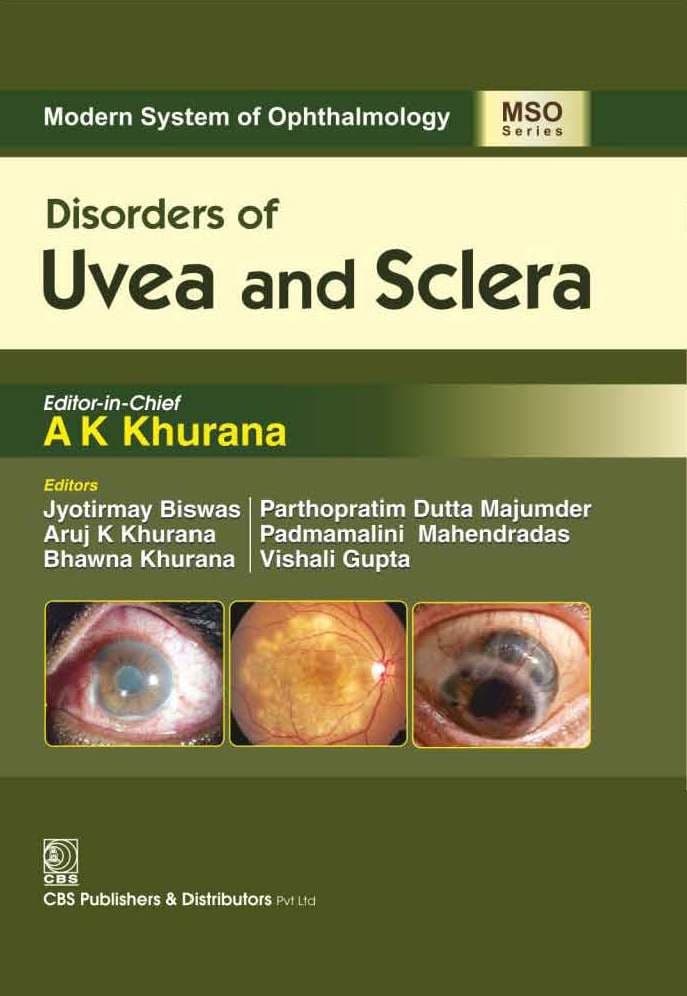 Disorders of Uvea and Sclera 1st/2016