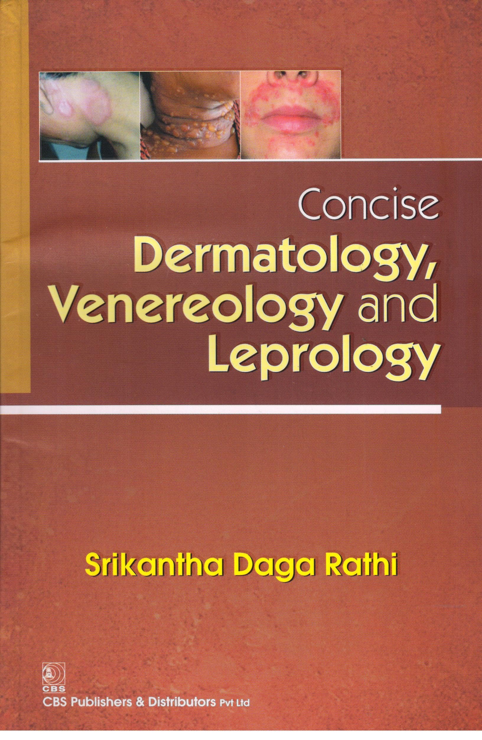 Concise Dermatology Venereology and Leprology 1st/2017