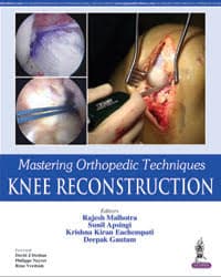 Mastering Orthopedic Techniques Knee Reconstruction 1st/2016