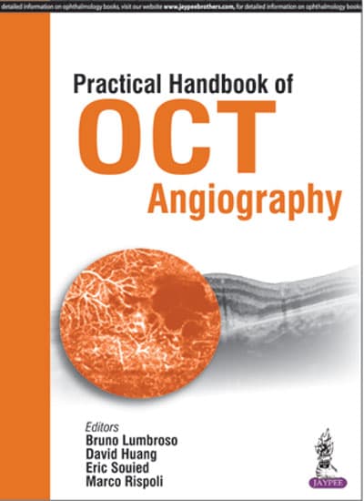 Practical Handbook of OCT: Angiography 1st/2016