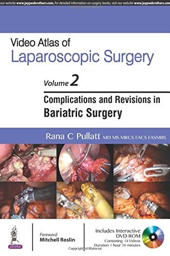 Video Atlas of Laparoscopic Surgery 2nd/2017 (Vol. 2)