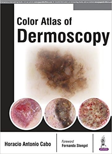 Color Atlas of Dermoscopy 1st/2017