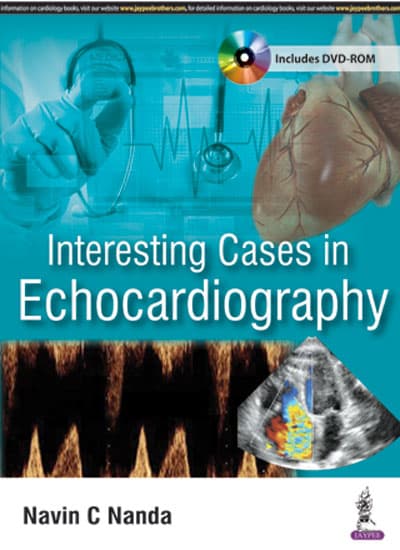 Interesting Cases in Echocardiography 1st/2017