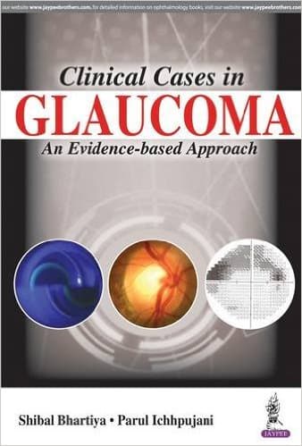 Clinical Cases in Glaucoma An Evidence Based Approach 1st/2017