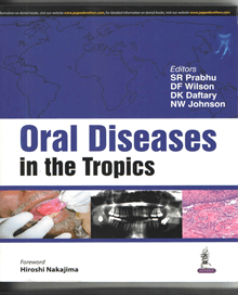 Oral Diseases in the Tropics 1st/2017