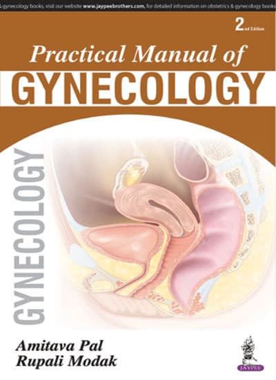 Practical Manual of Gynecology 2nd/2017