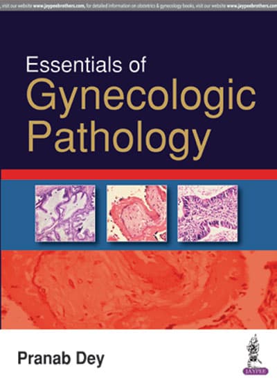 Essentials of Gynecologic Pathology 1st/2017