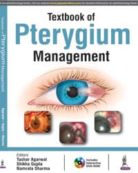 Textbook of Pterygium Management 1st/2017